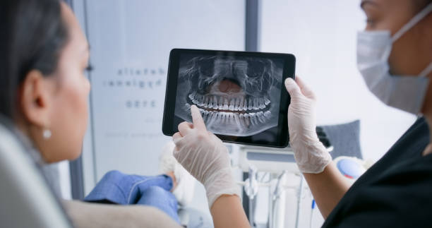Licensed Tooth Extraction service in Johnson County County, IA - Smile Center Dentistry